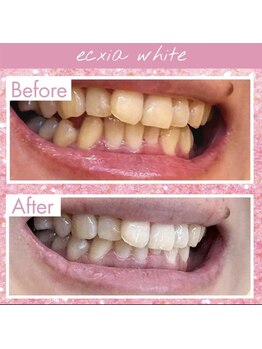 エクシアホワイト 長野店/