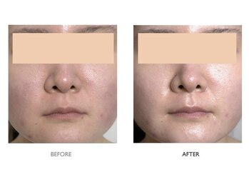 サロンドオフ 御堂筋店(salon de off)/