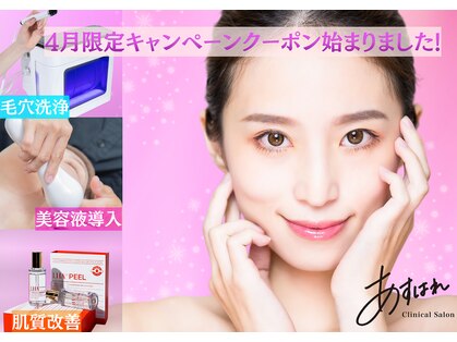 あすはれの写真