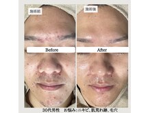 ル ボヌールの雰囲気(肌に合わせて剥げないハーブピーリングを組み合わせ♪無料相談OK)