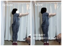 エイル(EIR)/腰痛・肩こり・首凝り