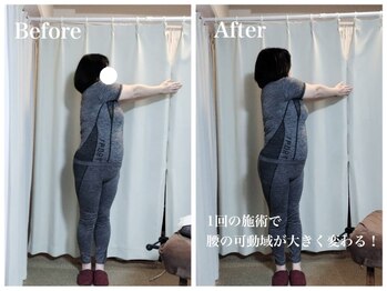 エイル(EIR)/腰痛・肩こり・首凝り