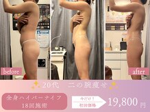 スリムプロ 天王寺店(Slimpro)/上半身ダイエット
