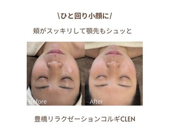 クレン(CLEN)/小顔コルギ