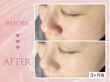 クリアラボ 上野(Clear Lab)/韓国肌管理&毛穴洗浄専門店