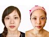 オススメ【小顔美肌コルギ】/首肩コリ/眼精.脳疲労改善/ 通常19400→9900