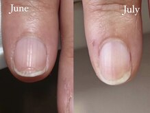 ネイルズ バイ ユイ 外苑前(Nails by Yui)/自爪育成ネイルケア