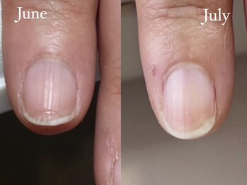 ネイルズ バイ ユイ 外苑前(Nails by Yui)/自爪育成ネイルケア