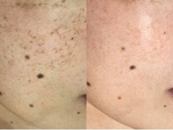 サクラ 伊勢原店(SAKURA)/どんな悩みも解決いたします。