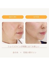 ムーンライズ(moonrise)/