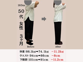 穴田鍼灸整骨院/【５０代　女性】ダイエット