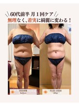ユナリ(yunari)/60代前半｜Before・Afte