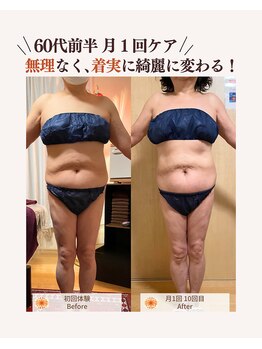 ユナリ(yunari)/60代前半｜Before・Afte