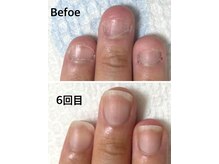 グラティアラ 銀座