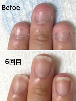 グラティアラ 銀座の写真/爪のお悩み卒業へ♪[初回肌爪カウンセリング&爪を育てるハンドケア（爪の形整え、甘皮お手入れ）¥12100]