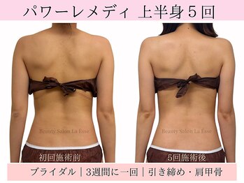 ラエッセ(La Esse)/美☆ブライダルエステ