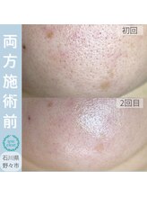 アズール(AZUL)/鼻だけじゃない！