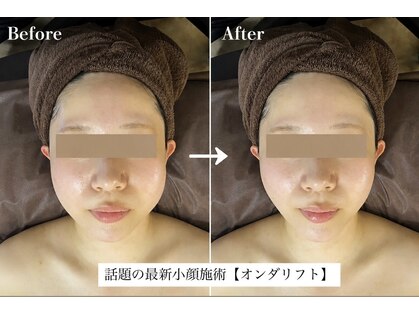 リフト 下北沢(Lift)の写真