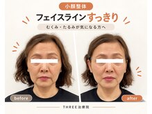 スリー治療院 伏見桃山(THREE治療院)の雰囲気（小顔整体｜ほうれい線・マリオネットライン・たるみ・むくみに◎）