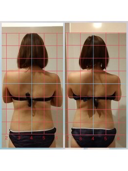 リノ(lino)/今話題のウィンバック♪