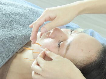 ソワン(Sowan)/スタンダート美容鍼