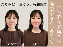 アントルーチェ 代々木上原(Entluce.)