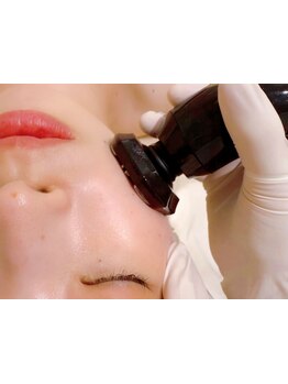 小顔になりたい