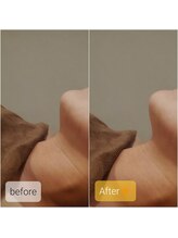 プリマ(prima)/美容看護師による施術