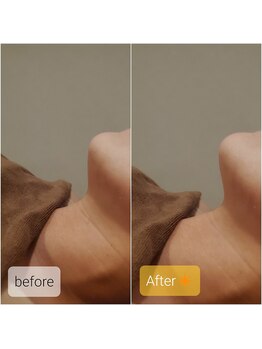 プリマ(prima)/美容看護師による施術