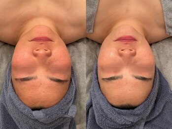 ポーデベロア(Peau des velours)/3月キャンペーン