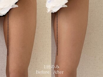 サロン ド ビビ(salon de bibi*)/太ももの隙間もつくれる！