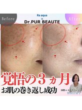 エステティックサロン ラ アクア(ra aqua)/覚悟の3ヵ月人生の巻き戻し成功