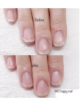 メイハッピー(MEI happy)/自爪育爪育成コース