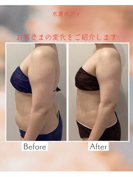 リシェル/二の腕☆ビフォーアフター