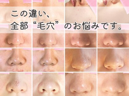 ロエヴェ(ROEWE)の写真