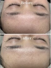 オーパーツ(OOPARTS)/シェービング/下北沢/ブライダル