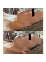 ラローゼ トウキョウ(LA ROSEE TOKYO)/潤い透明感と輪郭リフトで上質肌