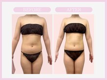 スリムライン 青森店(The Slim Line)/before→after