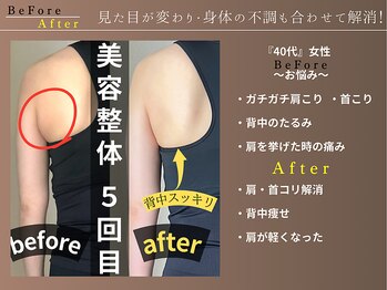 カケル(KAKERU)/施術とセルフケア指導でこの変化