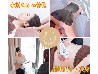 ラディアンスの写真