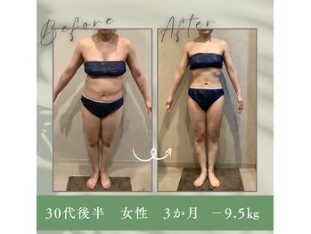 トータルボディサロン グリーン 日本橋駅前店(Green)/痩身マシン×リンパマッサージ