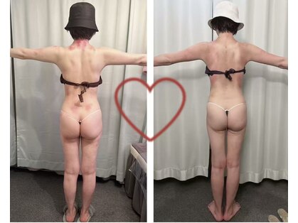 ハレ 麻布十番(Hare)の写真