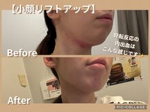 ボディリカバリー(Bodyリカバリー)/