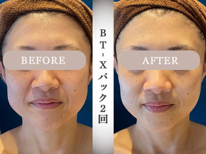 モルティー 広島店(Molti)の写真
