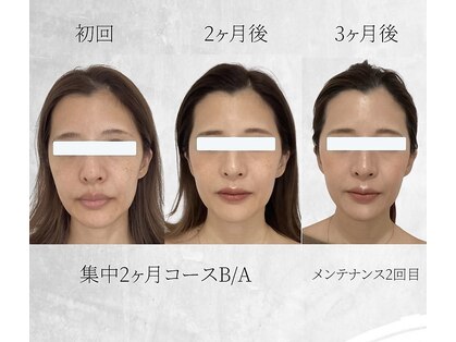 ビスイ 恵比寿(Bisui)の写真