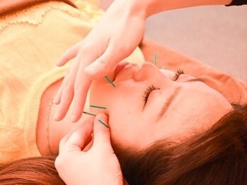 マイアート(My Art)/美容鍼でお肌悩み改善