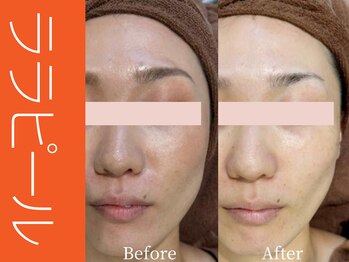 ビューティーリバース 大船店/ララピール50分