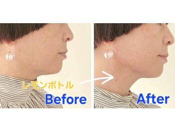 アン 銀座(ann)/レモンボトル