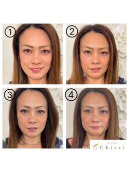 サロンチオリ 烏丸(Salon Chiori)の写真/【外からだけの矯正では効果が足りません】京都唯一!小顔×姿勢×口内の3方向矯正で《顔を根本から整える》