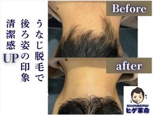 ヒゲ革命 難波日本橋の雰囲気（勧誘は一切ございません。無駄なくスピーディーに施術！）